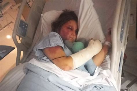 kirra hart 2023|Teen victim of brutal alleged bashing speaks out。